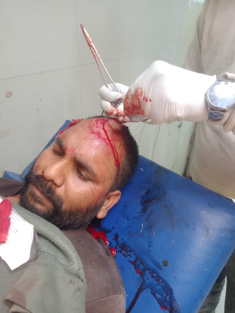 मड़ियाव में युवकों पर जानलेवा हमला, ईंट-पत्थर से पिटाई, एक की हालत गंभीर